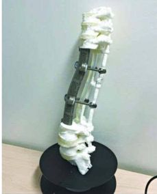 为什么3D打印人工骨