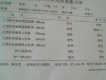 pmd报告是什么意思