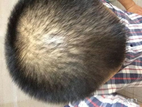 程序员鱼皮什么水平