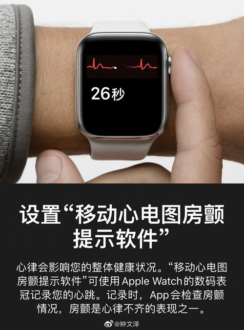 国行苹果手表Apple Watch如何开通ECG功能
