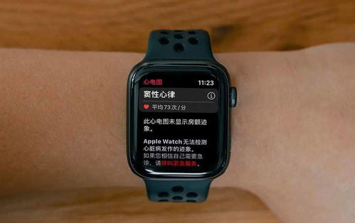 apple watch各版本功能有区别么