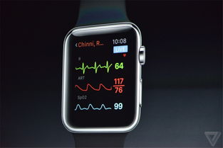 Apple Watch对于人体健康究竟有着多大的意义