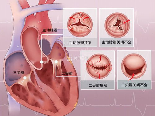 一般心电图和超声心电图有什么区别