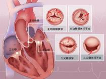 一般心电图和超声心电图有什么区别